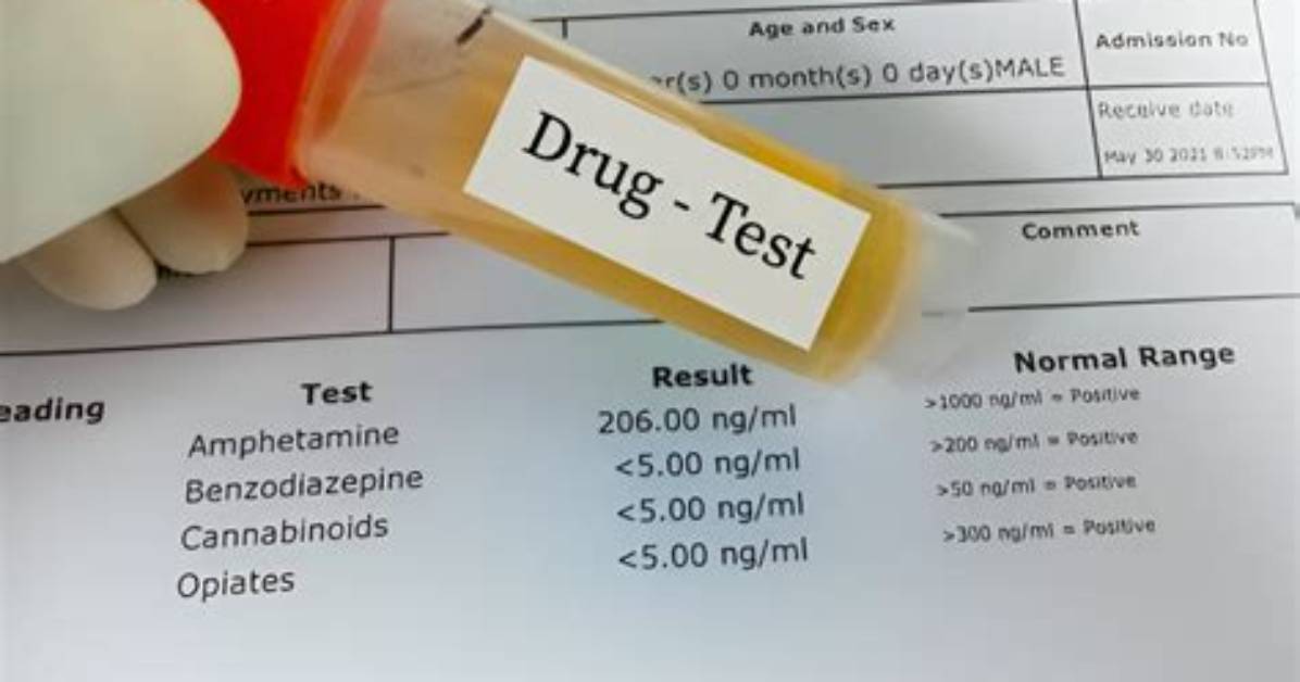 Do Scheels Drug Test?