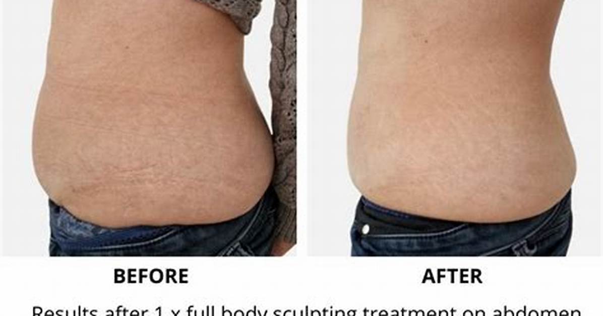 Do Sculpt Pods Really Work?
