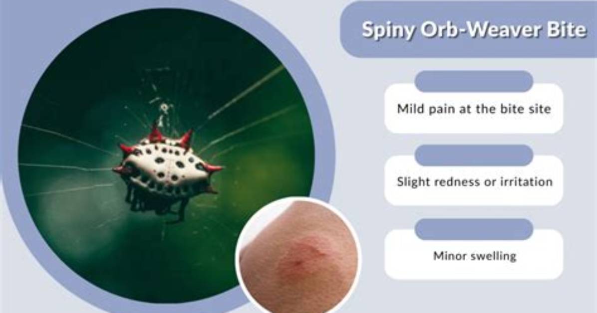 Do Spiny Orb Weavers Bite?