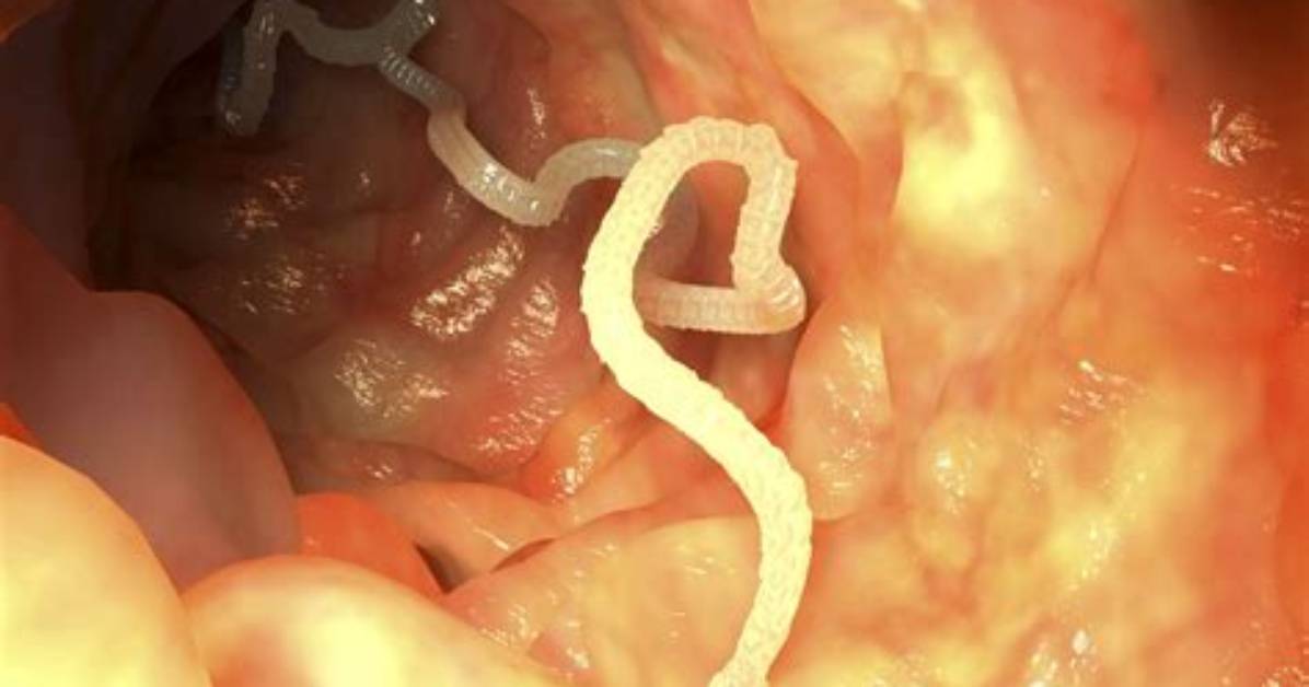 Do Tapeworms Have Hearts?