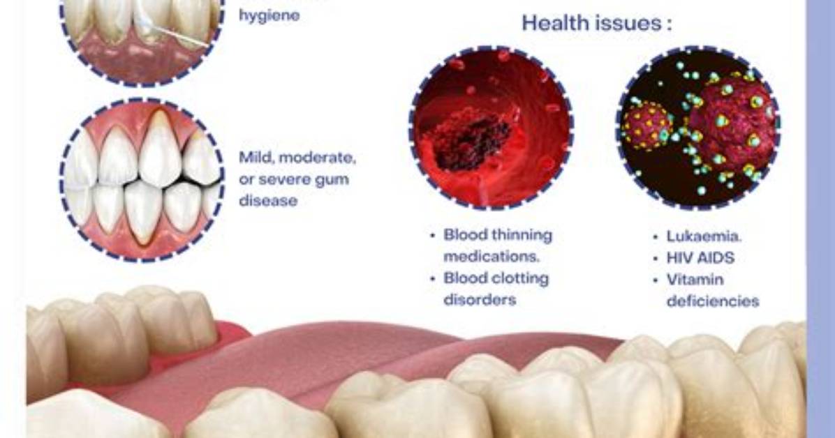 Do Teeth Have Blood?