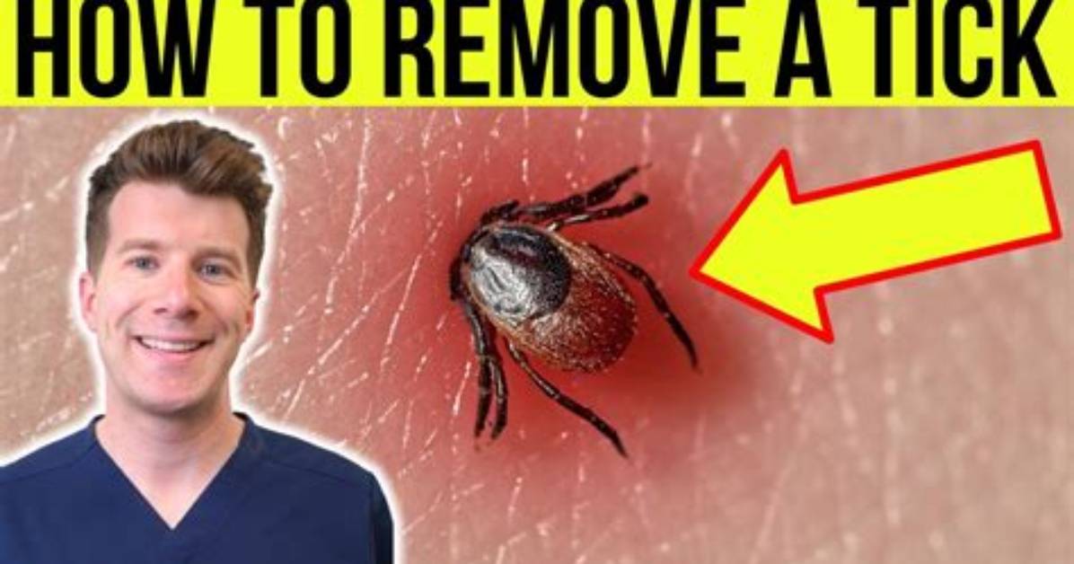 Do Ticks Burrow Completely Under the Skin?