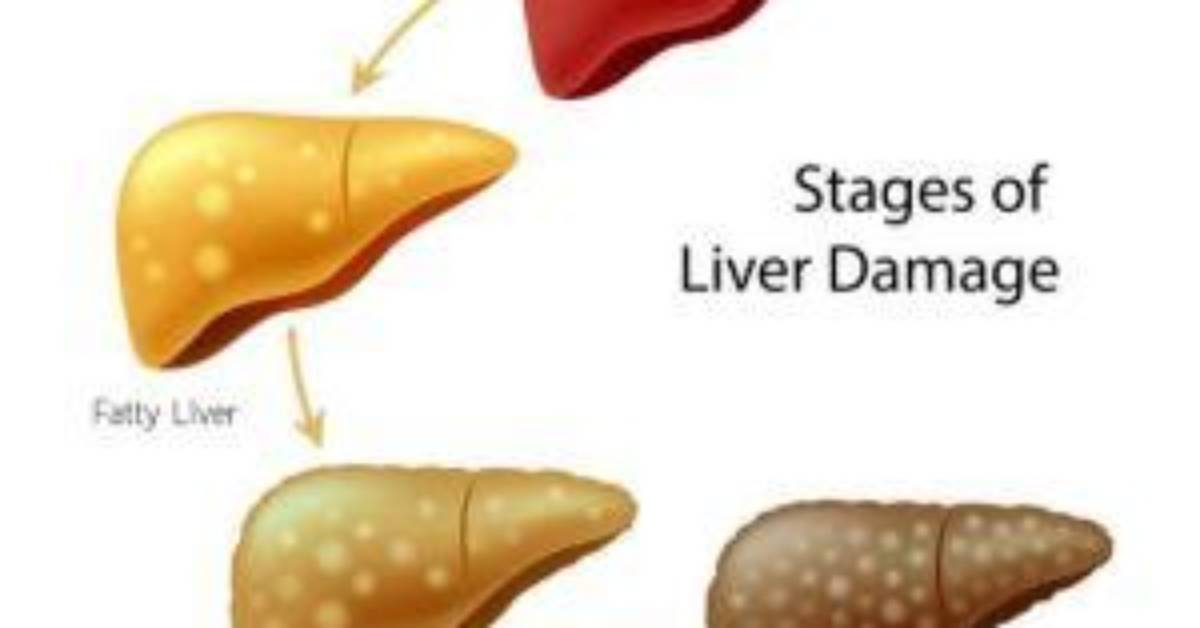 Do We Have 2 Livers?