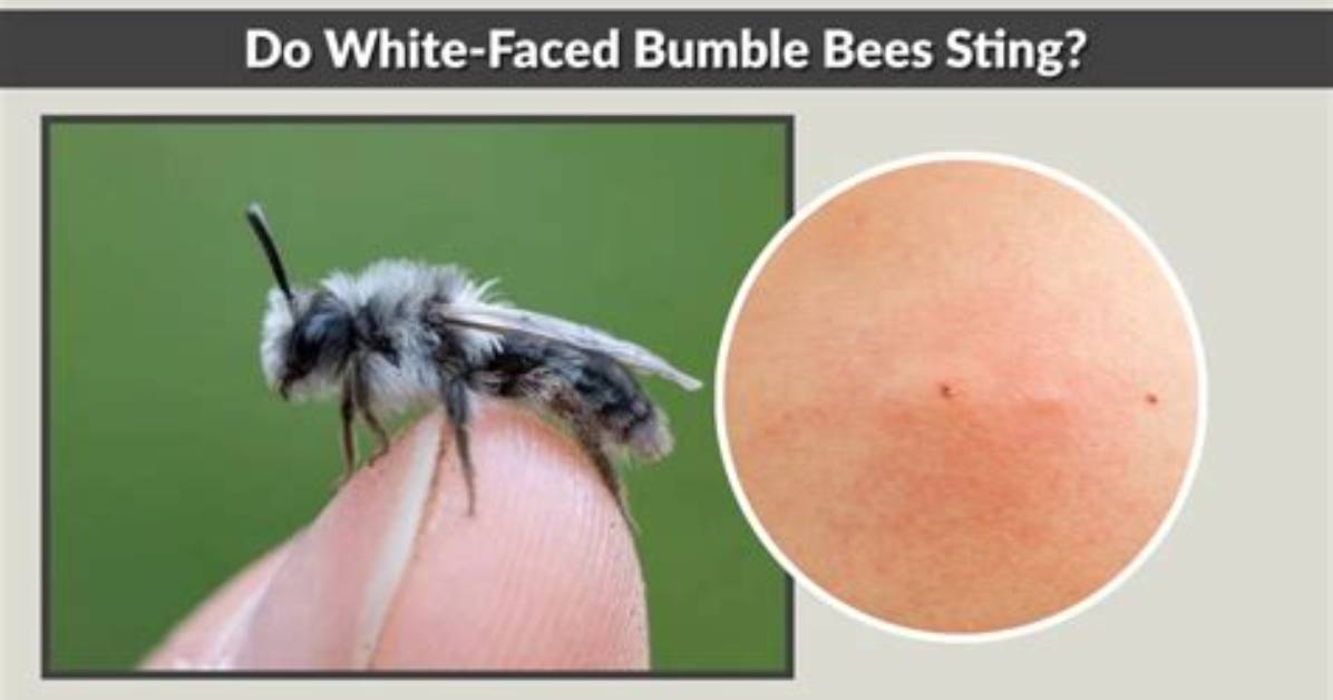 Do White Faced Bumble Bees Sting?