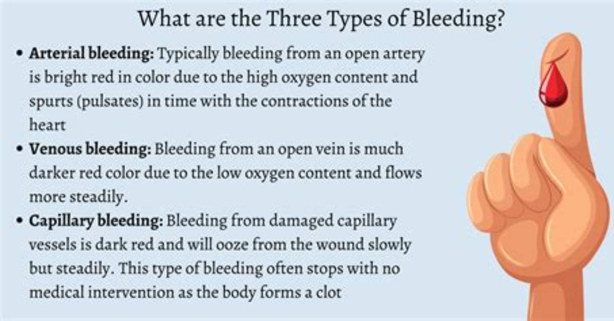 Do You Bleed After a D&C?