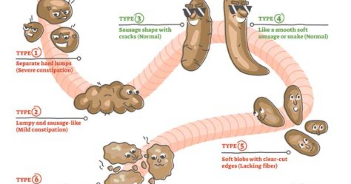Do You Have Bowel Movements When Dying?
