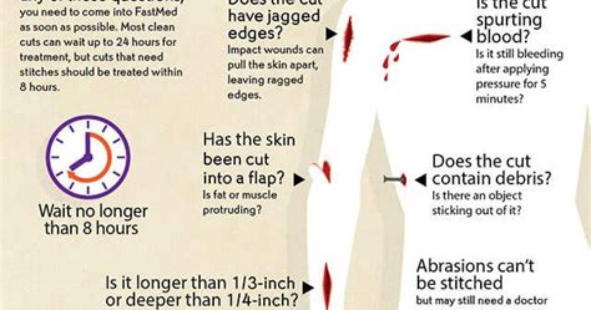 Do You Need Stitches After a Punch Biopsy?