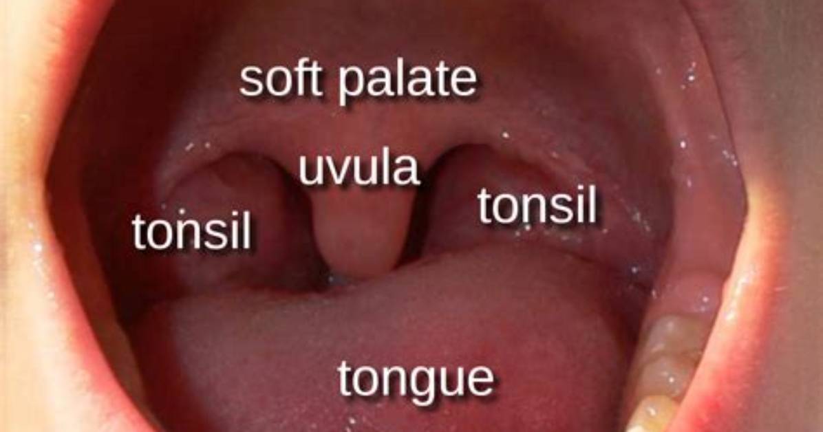 Do You Need Your Uvula?