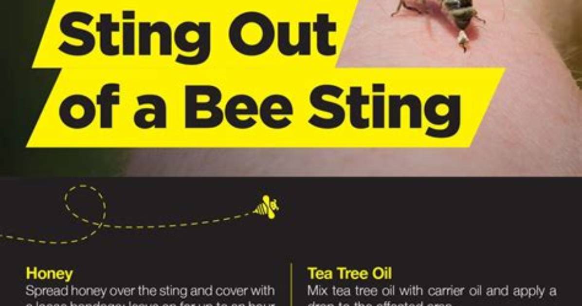 Do You Put on a Bee Sting?