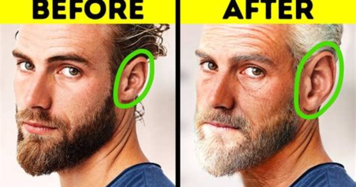 Do Your Ears Stop Growing?