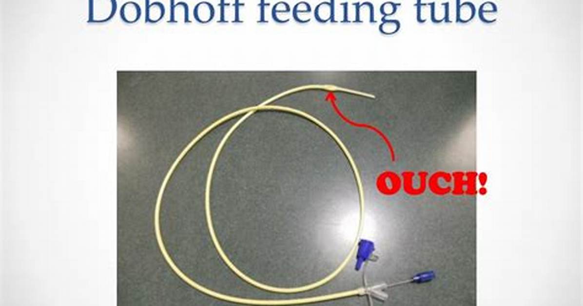 Dobhoff Tube