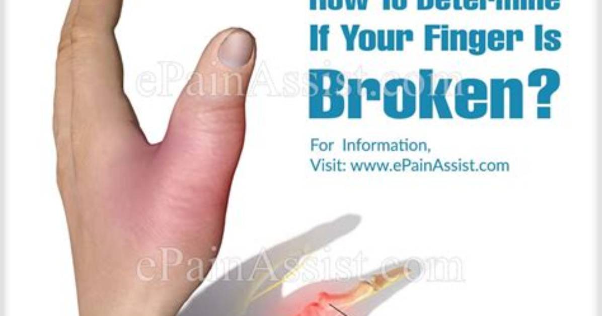 Does a Broken Finger Ache?