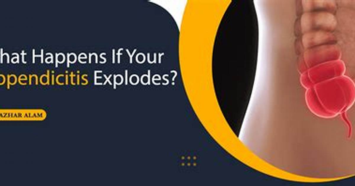 Does a Burst Appendix Hurt?