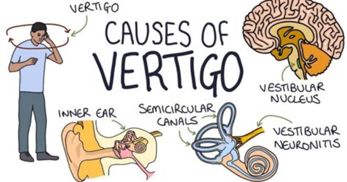 Does a Hot Bath Help Vertigo?