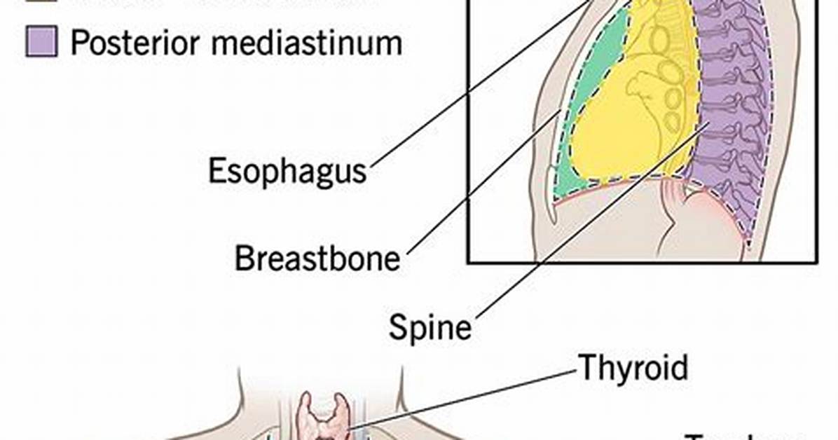 Does a Mediastinal Mass Hurt?