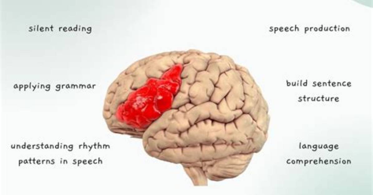 Does a Sheep Brain Have a Broca's Area?
