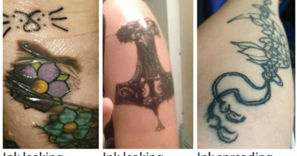 Does a Tattoo Leak Ink?