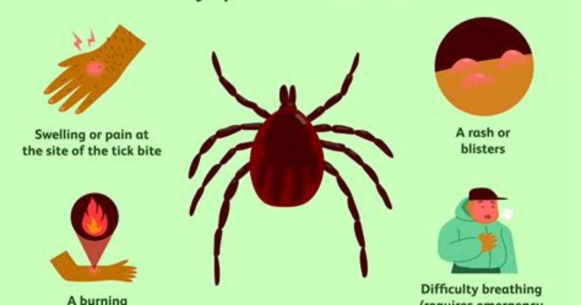 Does a Tick Bite Twice?