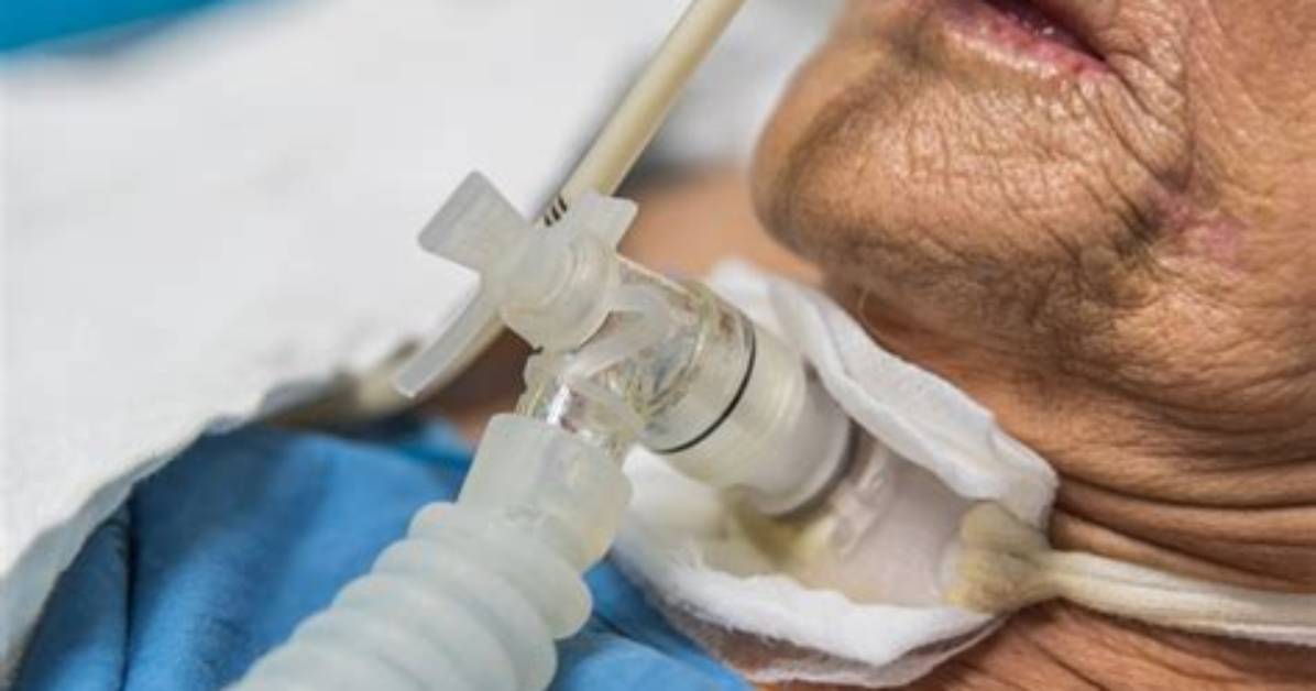 Does a Tracheostomy Replace a Ventilator