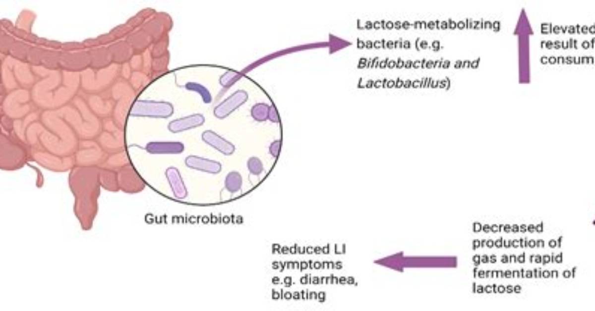 Does Acidophilus Have Lactose