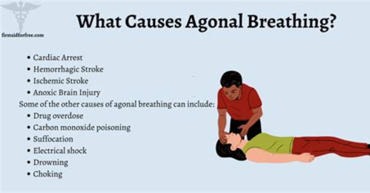 Does Agonal Breathing Mean Death?