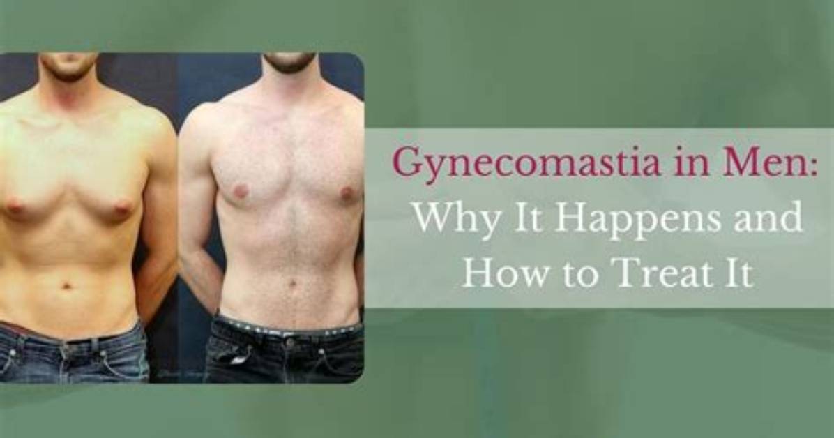 Does Alcohol Cause Gynecomastia?