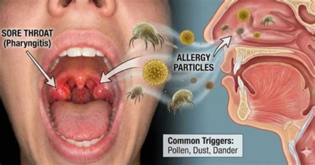 Does Allergies Cause Sore Throat?