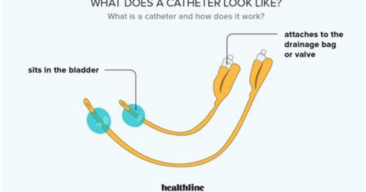 Does an Indwelling Catheter Hurt?