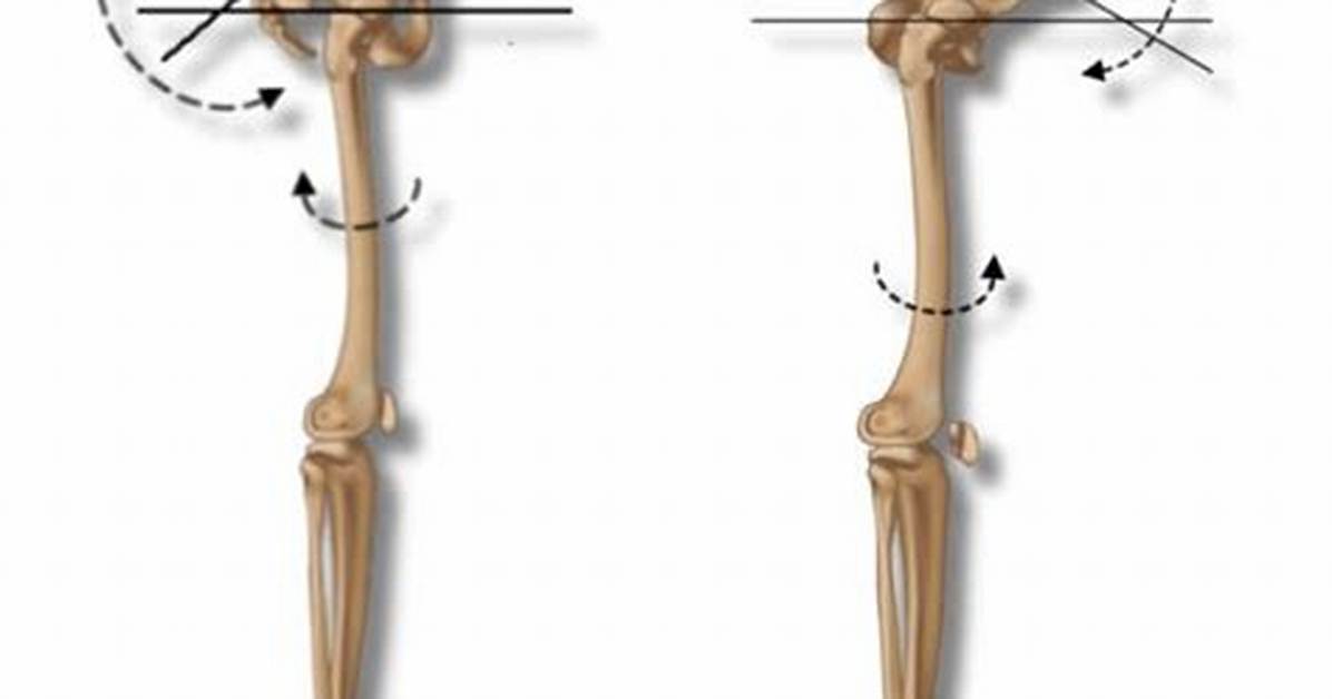 Does Anteriorly Mean Forward?