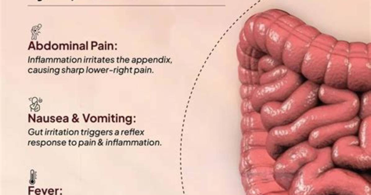 Does Appendicitis Hurt to Breathe?