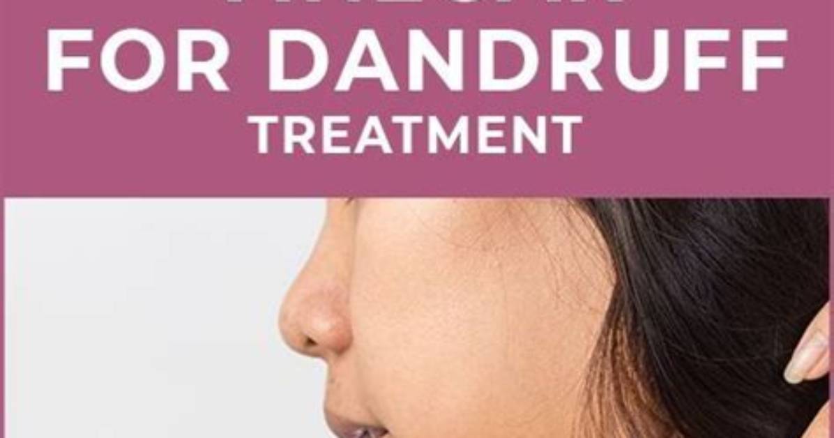 Does Apple Cider Vinegar Help Cure Dandruff?