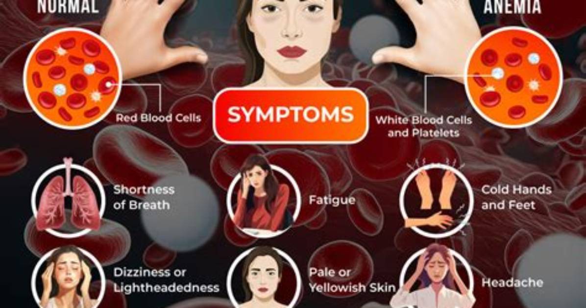 Does Ascaris Cause Anemia?