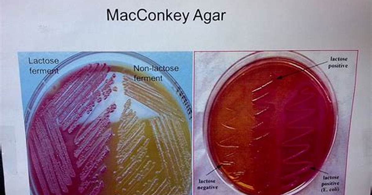 Does Bacillus Cereus Grow on Macconkey Agar?