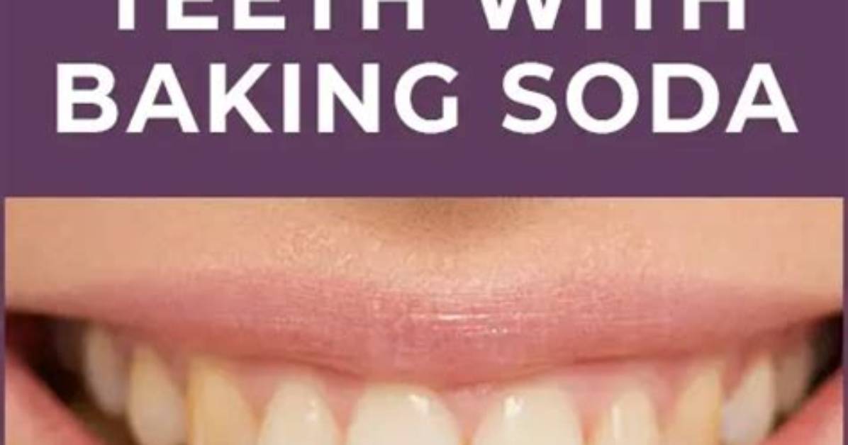 Does Baking Soda Whiten Teeth