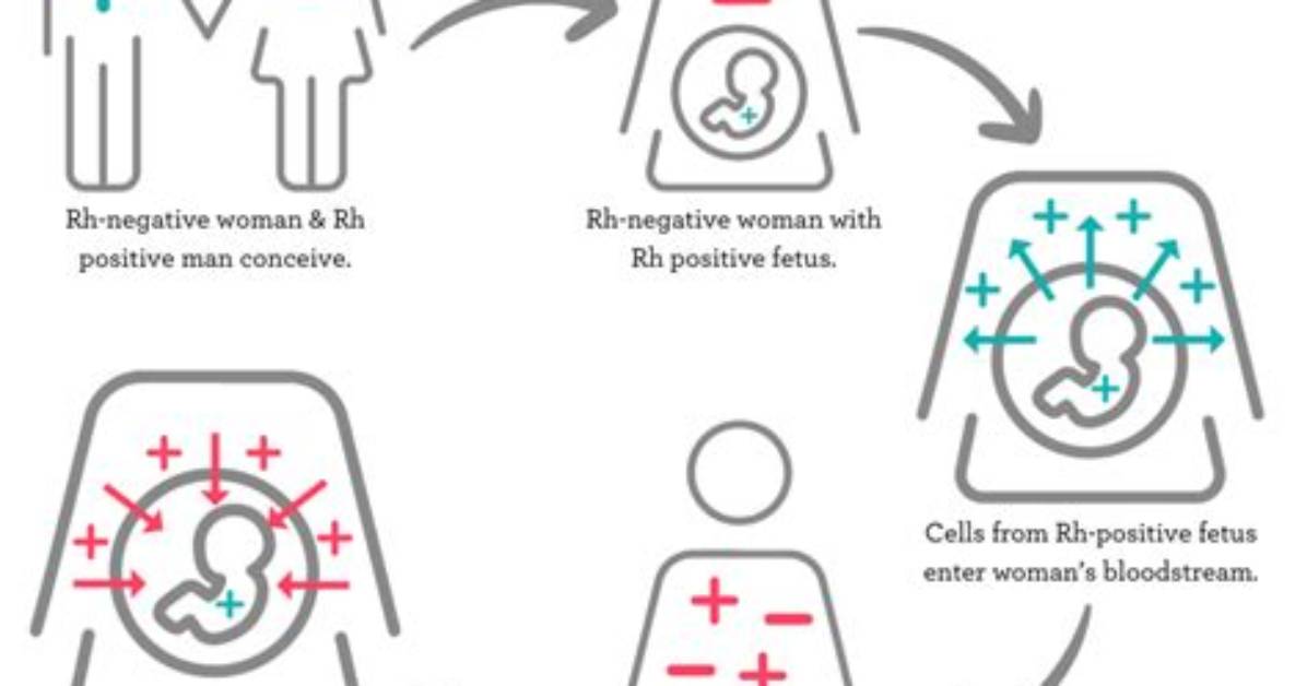 Does Being Rh Negative Make You High Risk?