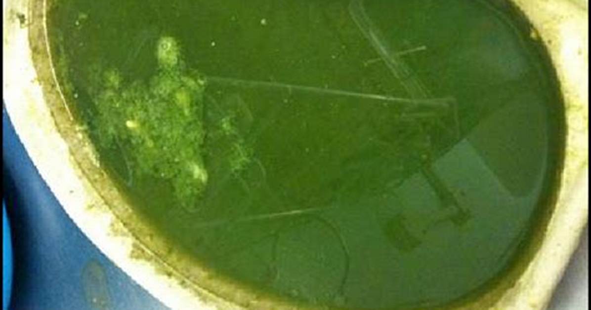 Does Bilious Vomiting Mean?