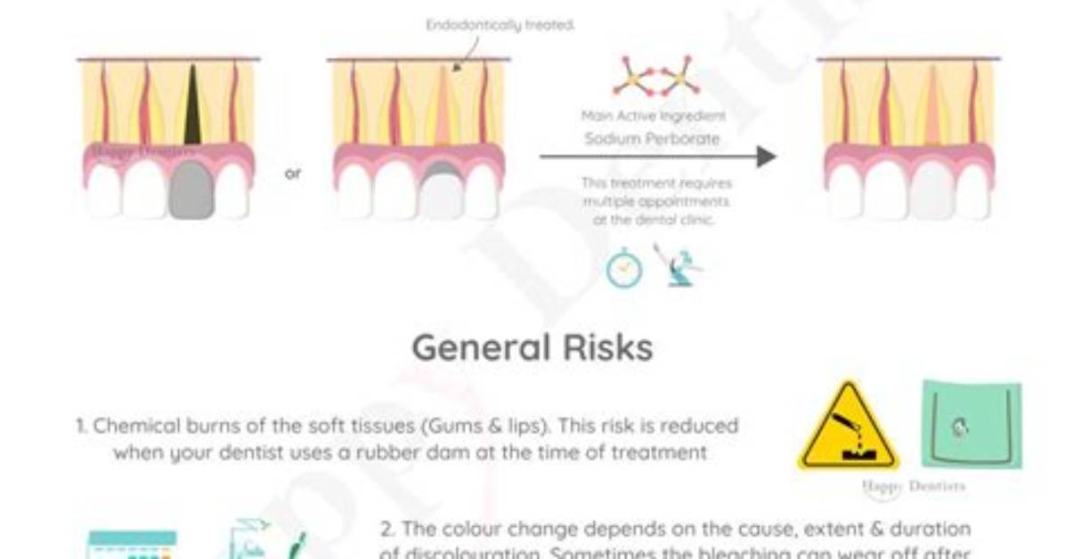 Does Bleaching Shoelaces Work?