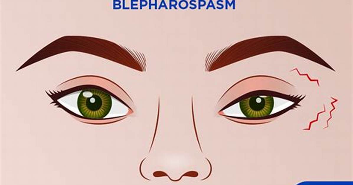 Does Blepharospasm Affect Both Eyes?