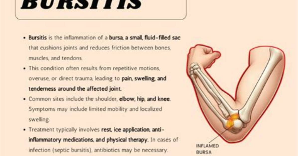 Does Bursitis Cause Nerve Pain?