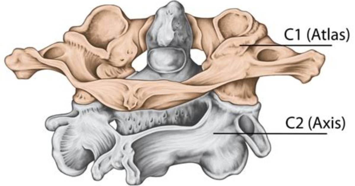 Does C2 Have a Vertebral Body?