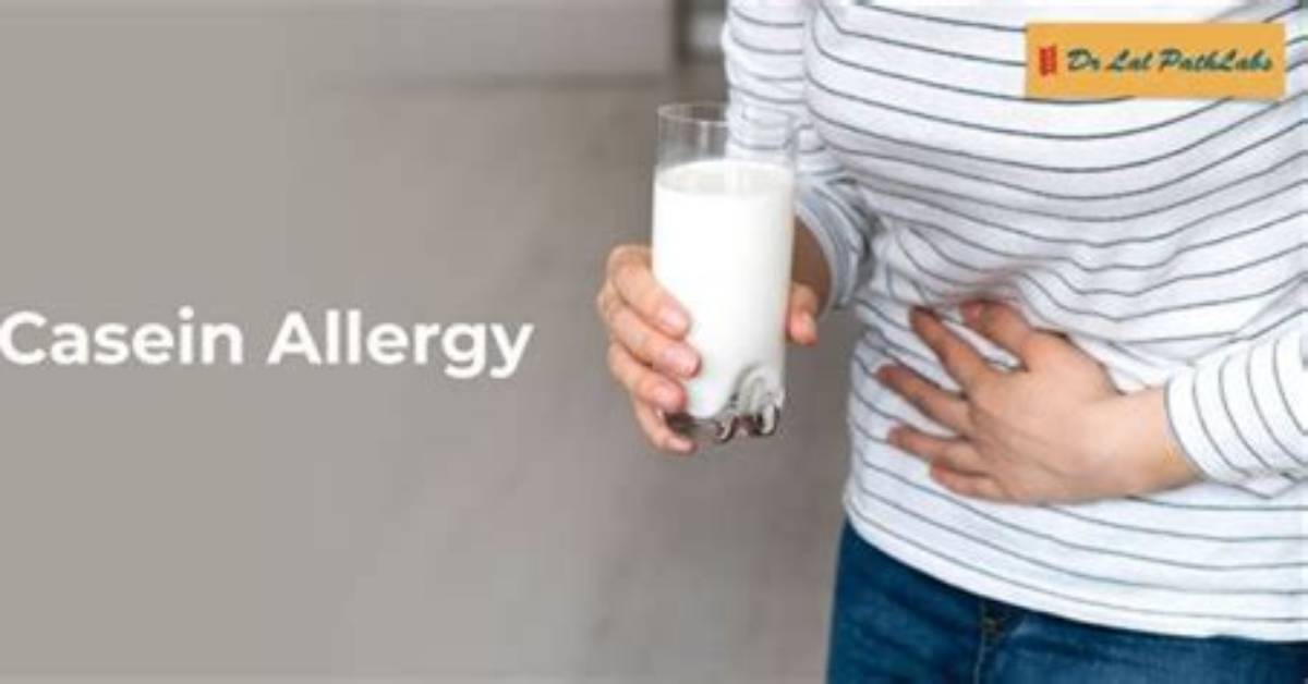 Does Casein Cause Allergy