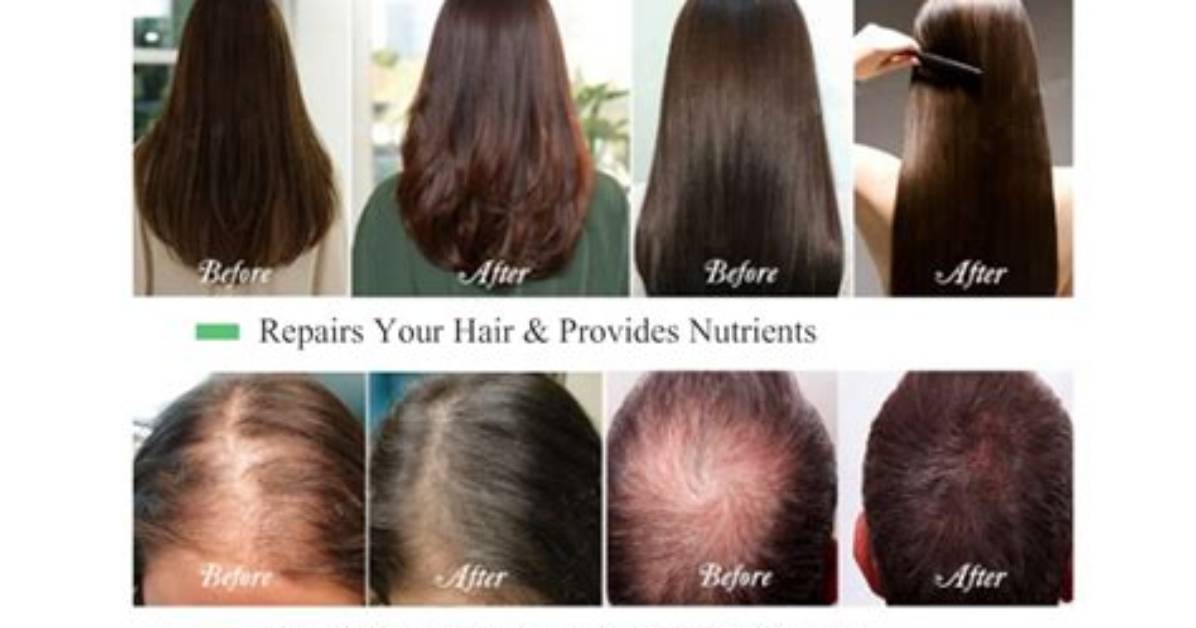 Does Castor Oil Grow Hair on Bald Spots?