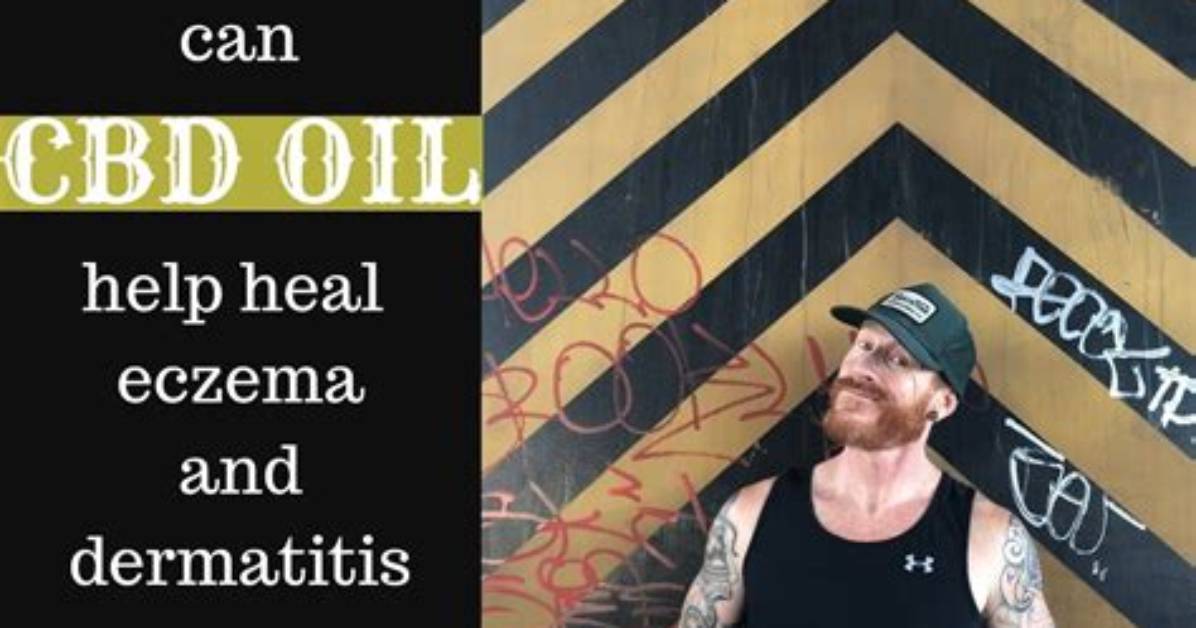 Does Cbd Oil Help Atopic Dermatitis?