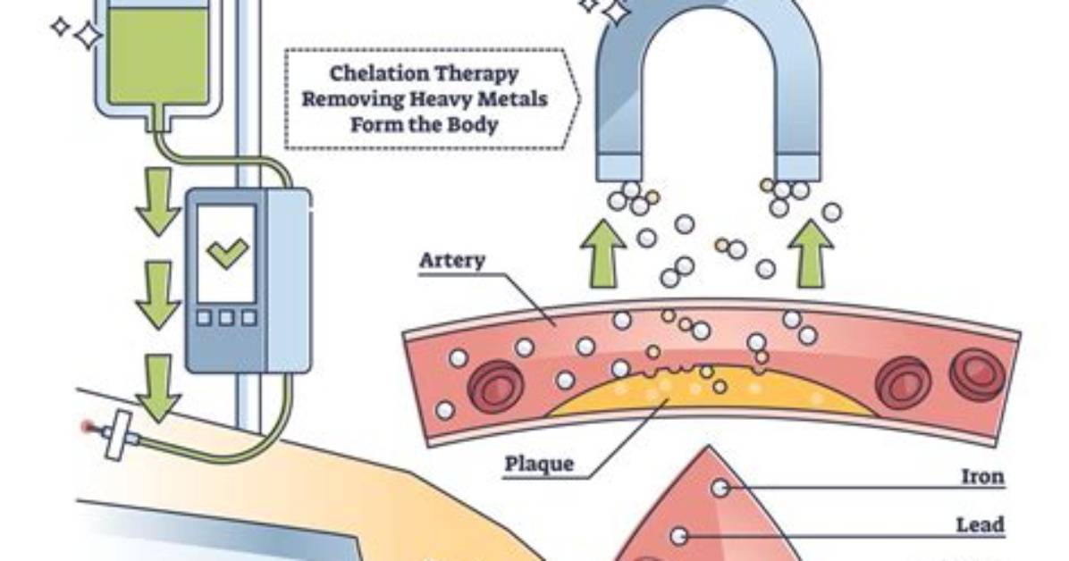 Does Chelation Remove Lead?