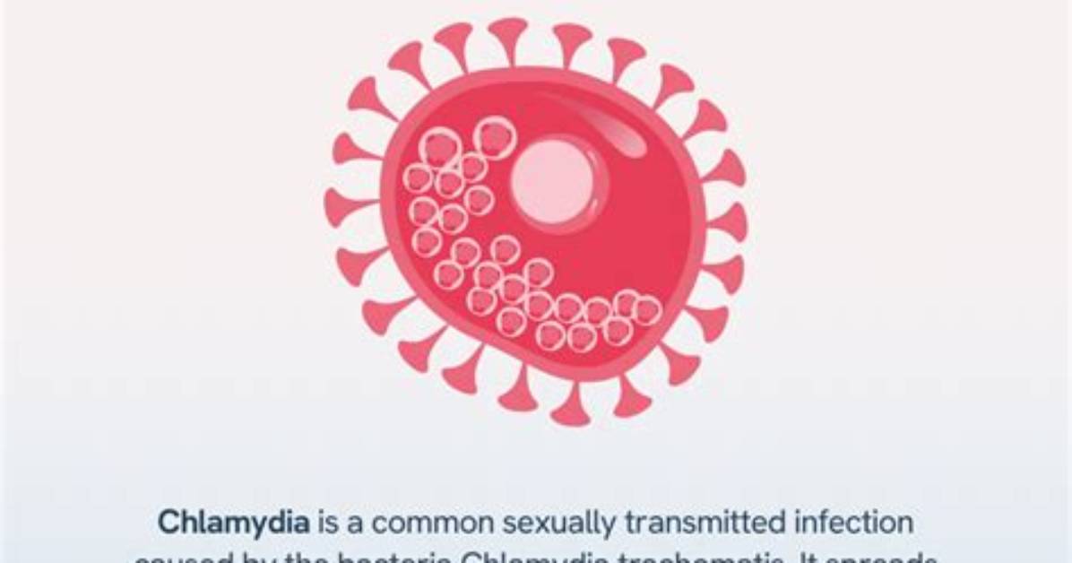 Does Chlamydia Trachomatis Have a Capsule?