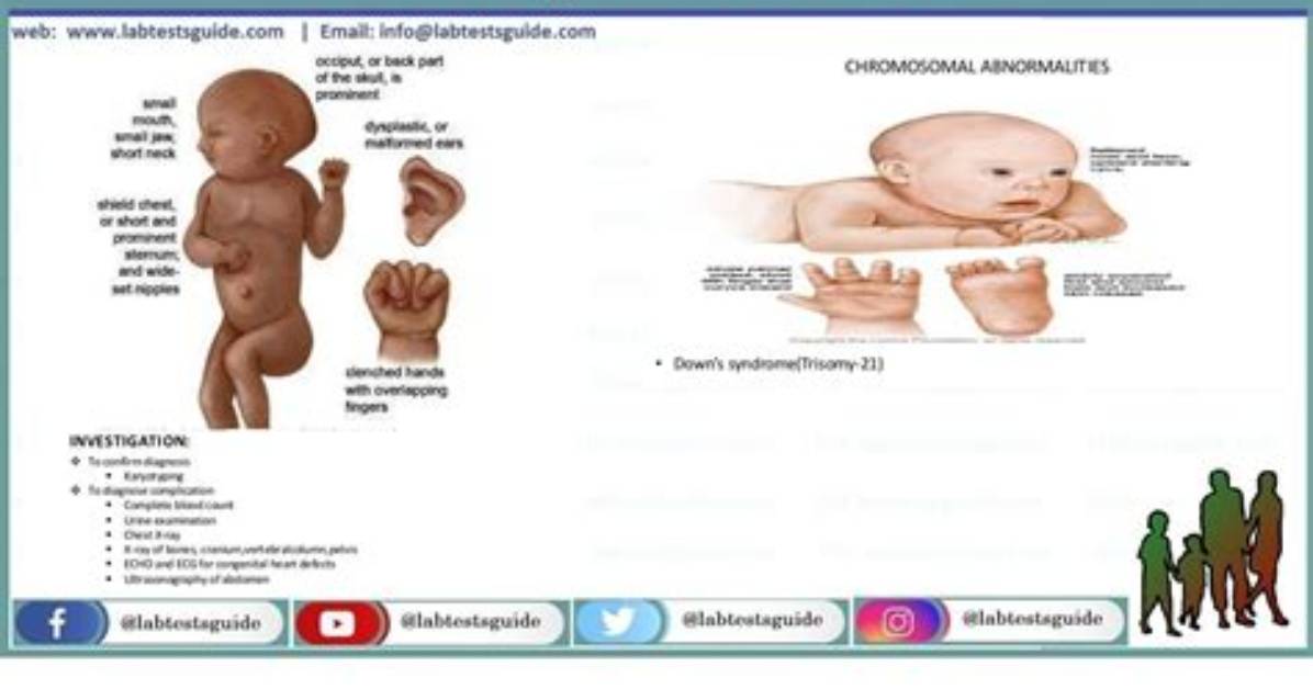 Does Congenital Abnormality Mean?