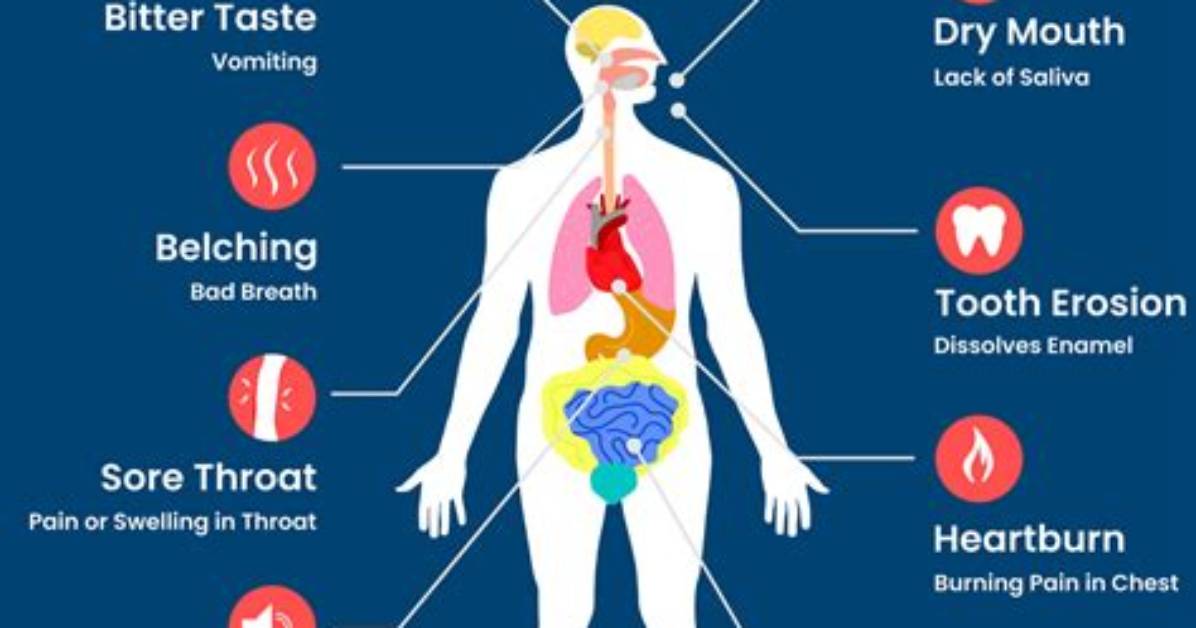 Does Covid Feel Like Acid Reflux?