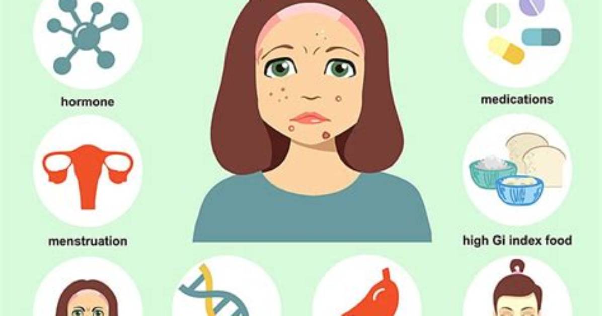 Does Crying Cause Acne?