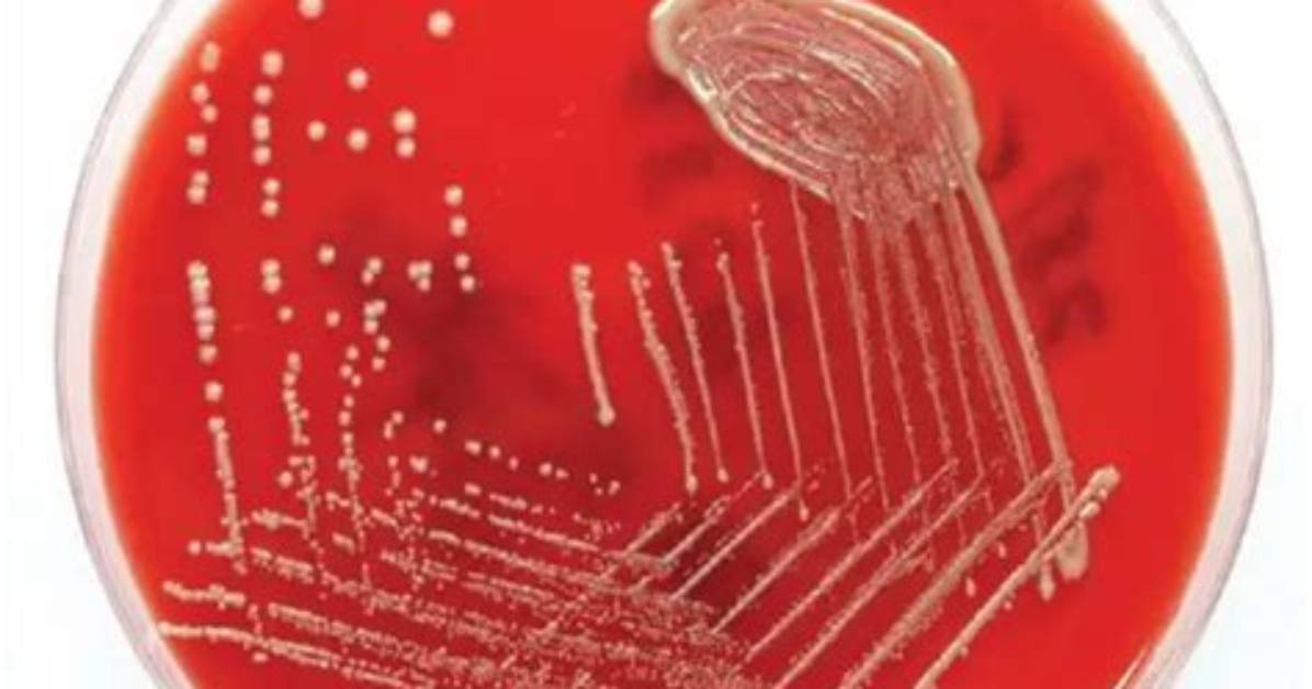 Does Cryptococcus Neoformans Grow on Blood Agar?