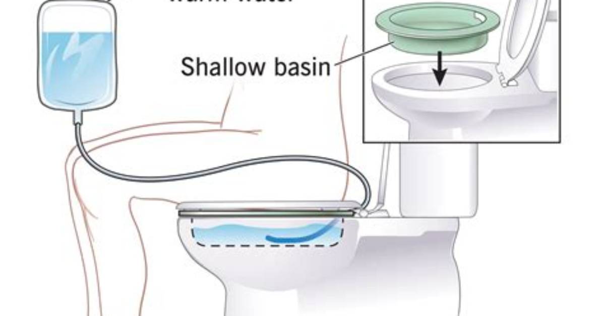 Does Cvs Sell Sitz Bath